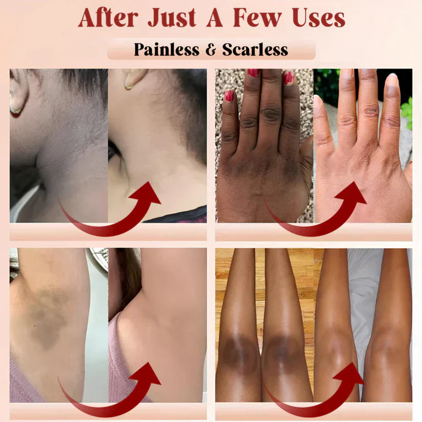 Orange Enzyme  Gel